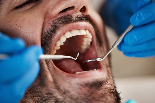 Best Emergency Root Canal Treatment in Saco, ME