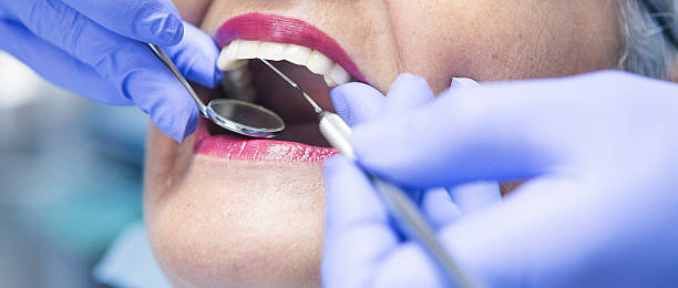 Best Emergency Tooth Extraction in Saco, ME